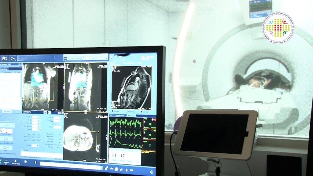 Procedură unică în vestul țării într-un spital public – RMN-ul cardiac de stres